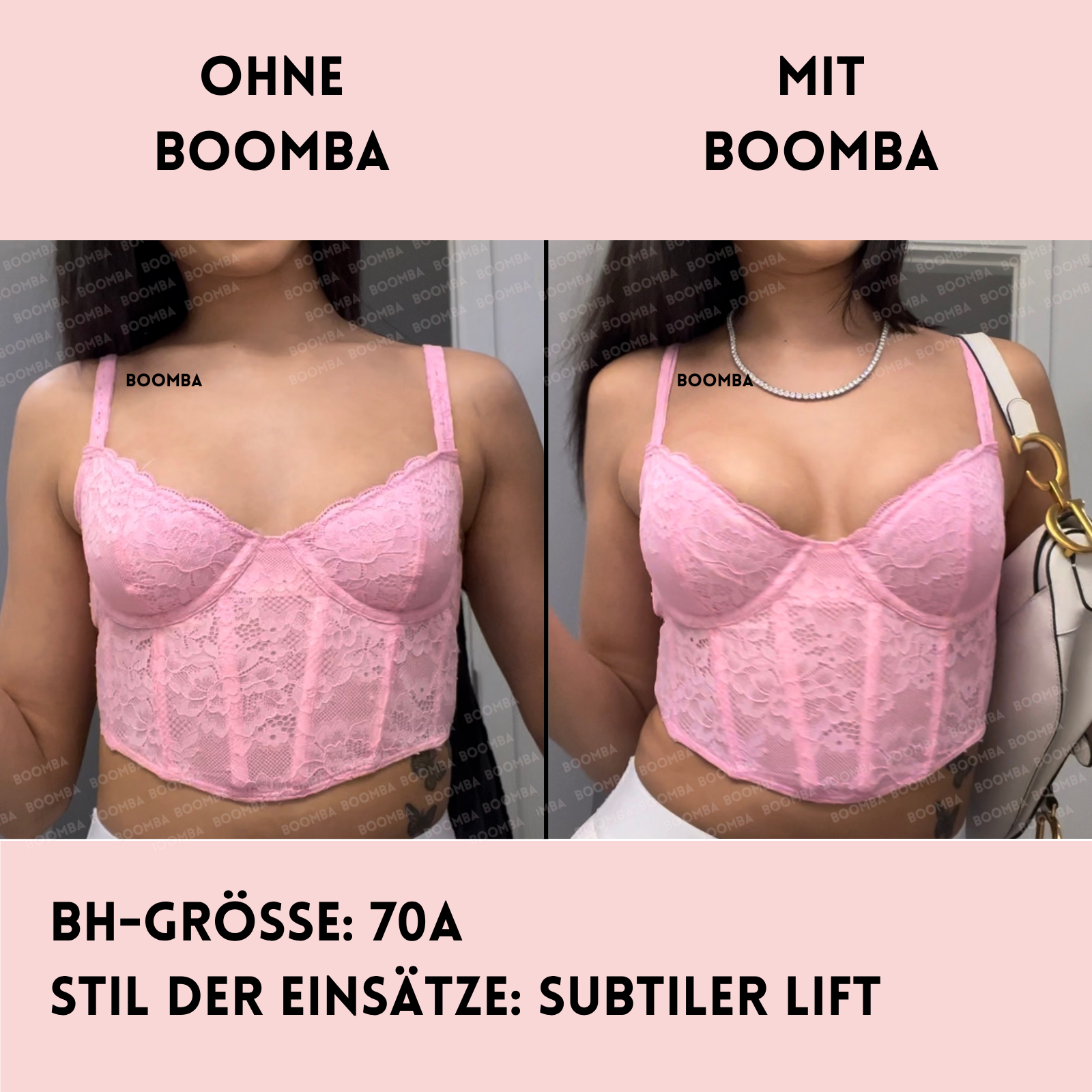 Subtiler Lift Einlagen