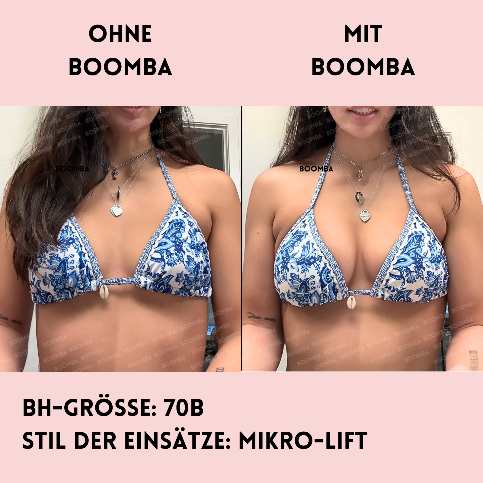 Mikro-Lift Einlagen (Zwei Paar)