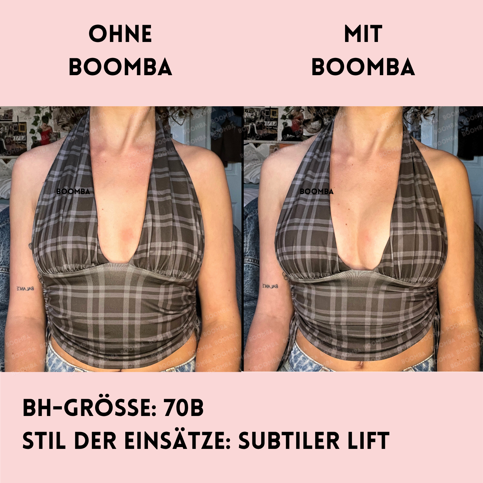 Subtiler Lift Einlagen