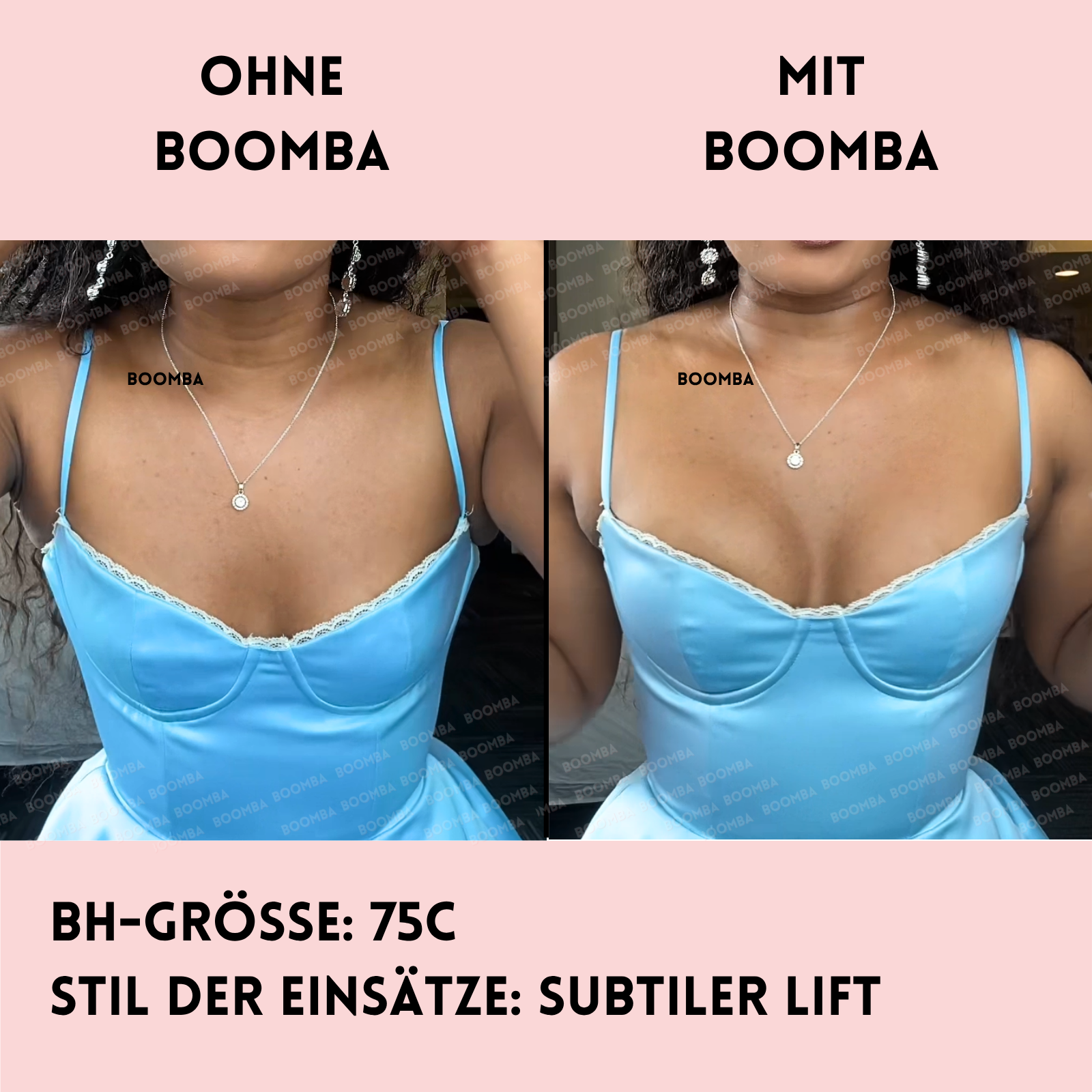 Subtiler Lift Einlagen