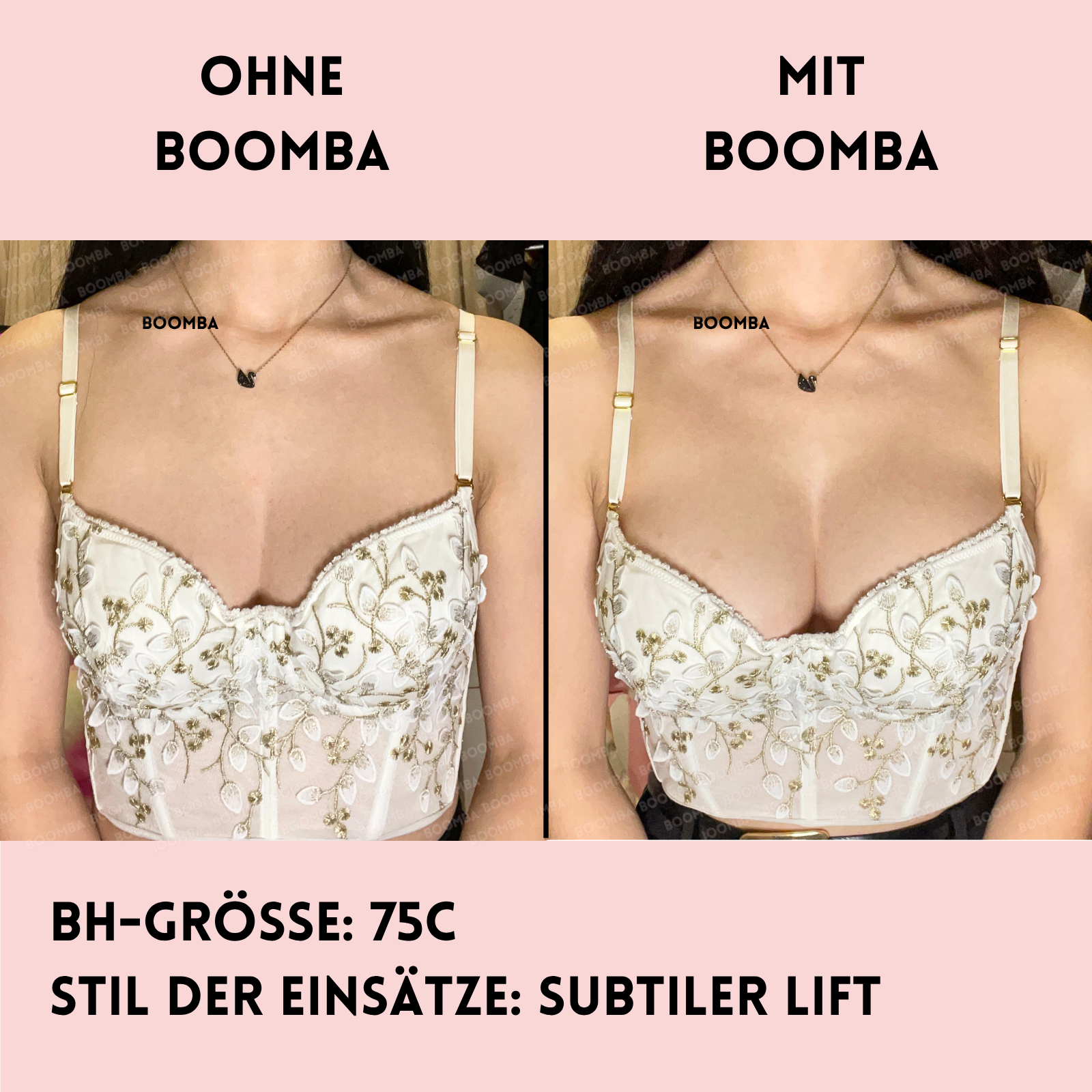 Subtiler Lift Einlagen