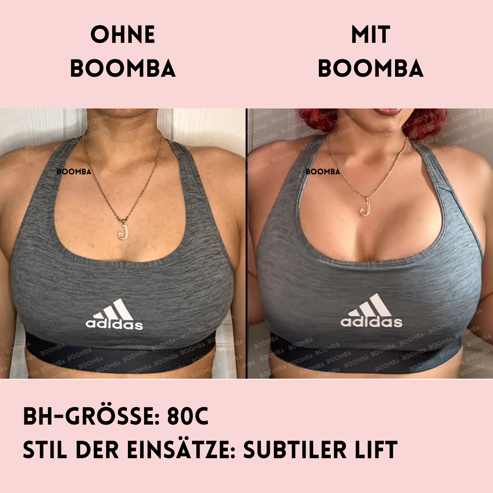 Subtiler Lift Einlagen