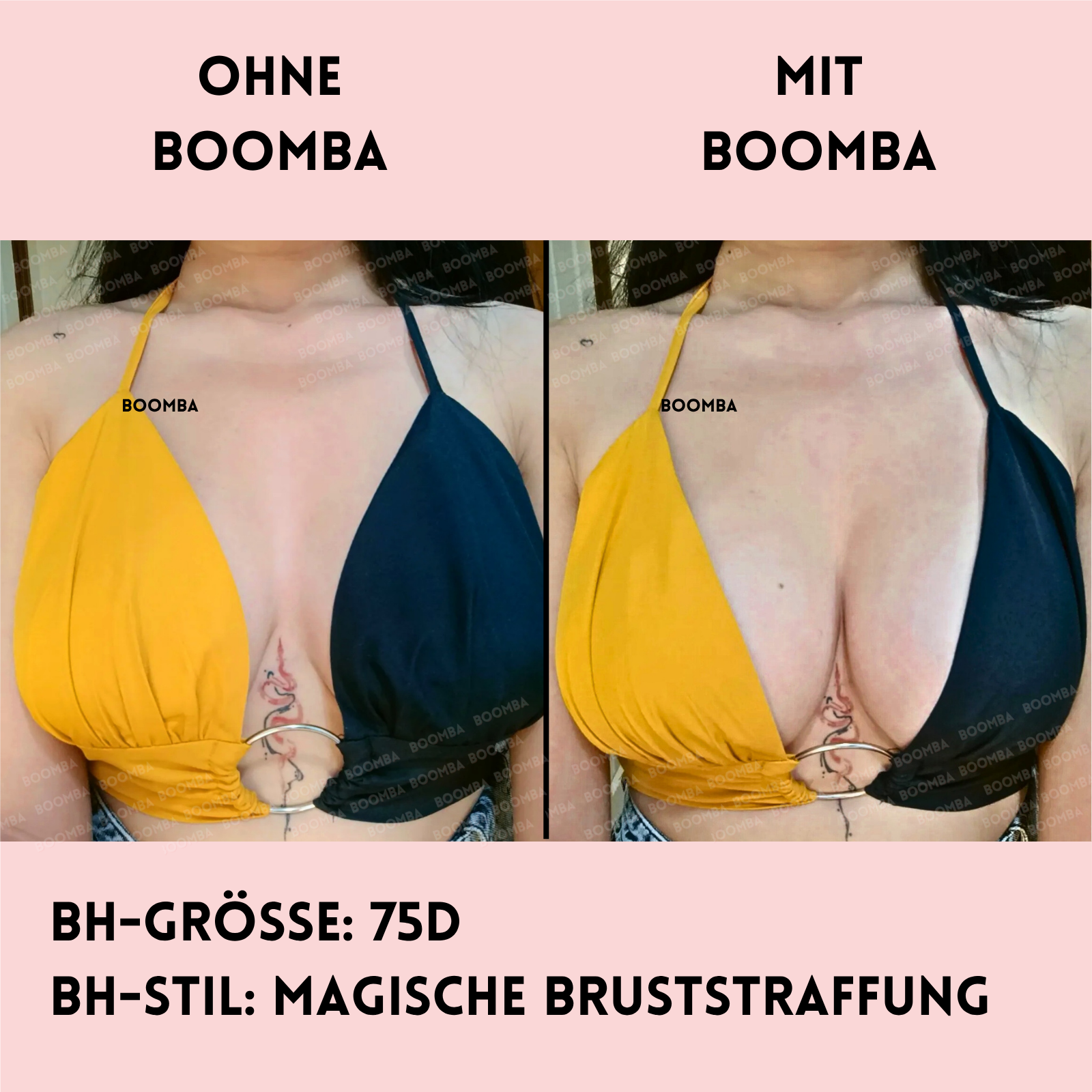 Magische Bruststraffung