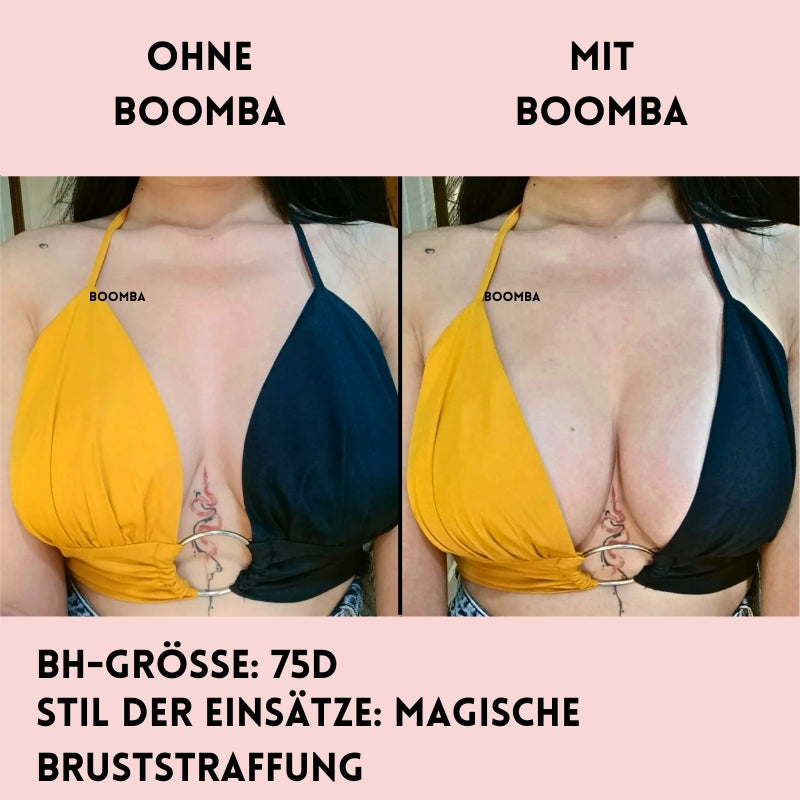 Magische Bruststraffung